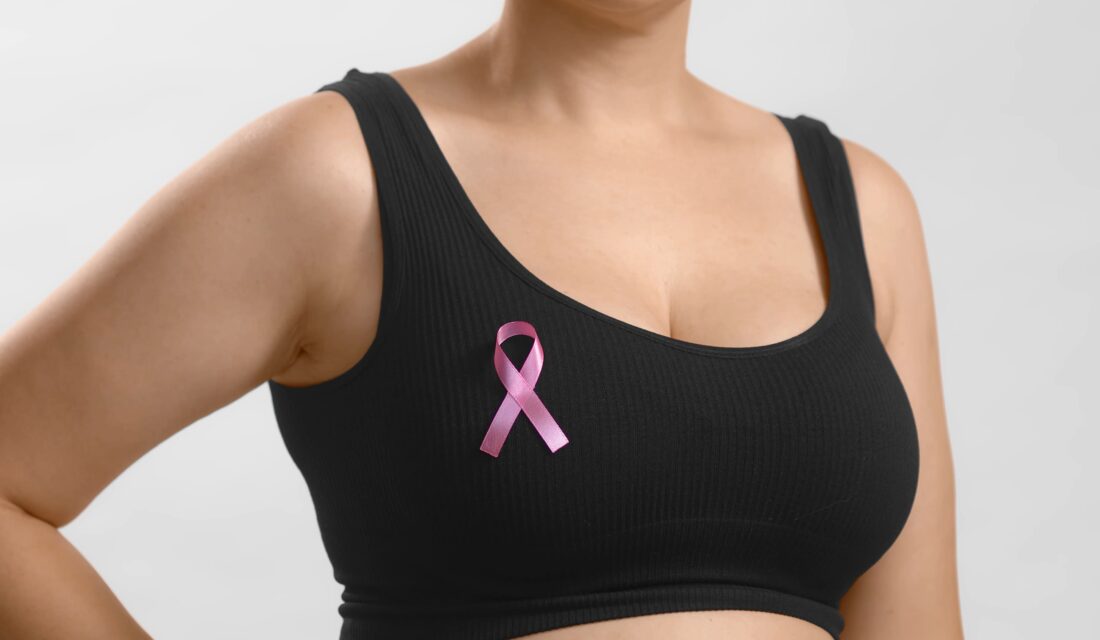 Prédisposition génétique : mastectomie prophylactique bilatérale