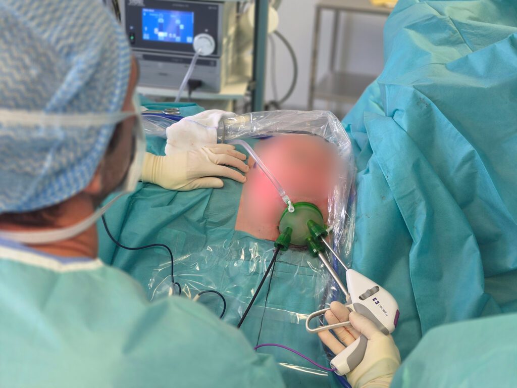 les instruments de chirurgie du sein par voie endoscopique posés sur une patiente